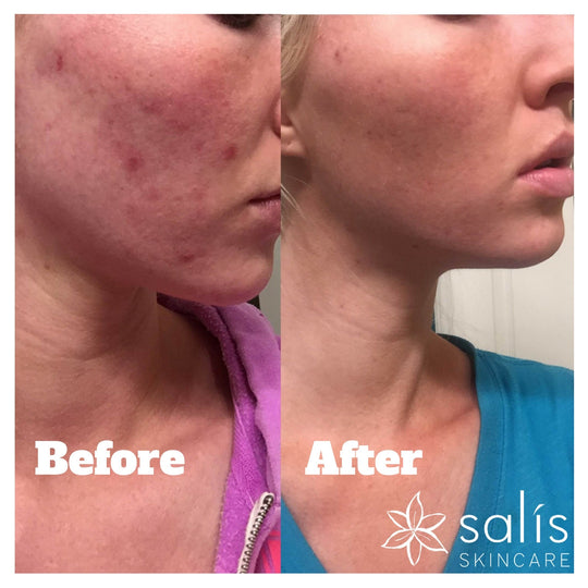 Before and After for Maranda