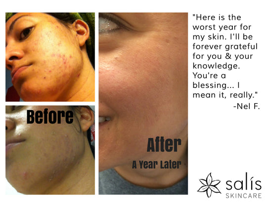 Nelssie Before and After